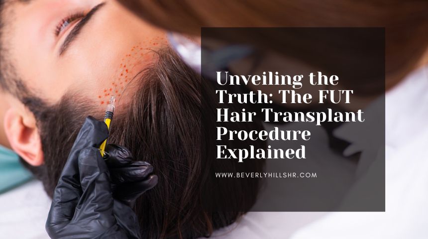 Unveiling the Truth: The FUT Hair Transplant Procedure Explained